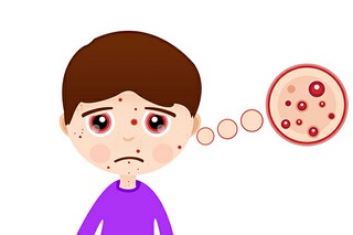 瘿庵《瘿庵诗集》介绍_瘿是什么意思呢_